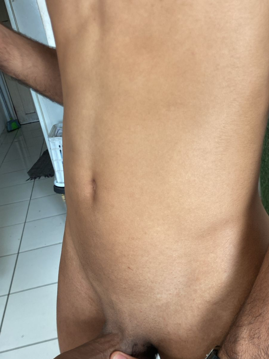 Foto do Erre