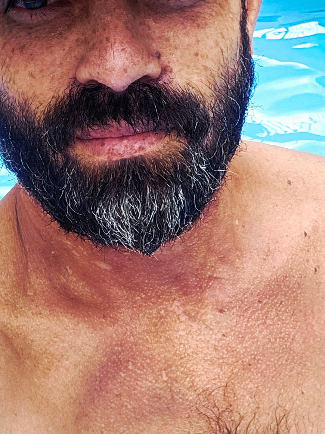 Foto da Acompanhante Puto BV